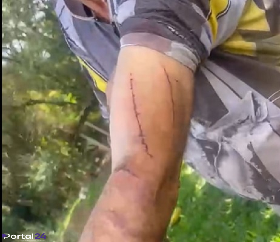 Agricultor de 76 anos sobrevive após entrar em luta corporal com onça-parda em Toledo