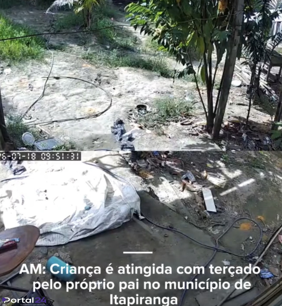 Criança de 6 anos é ferida com golpe de terçado pelo próprio pai no Amazonas