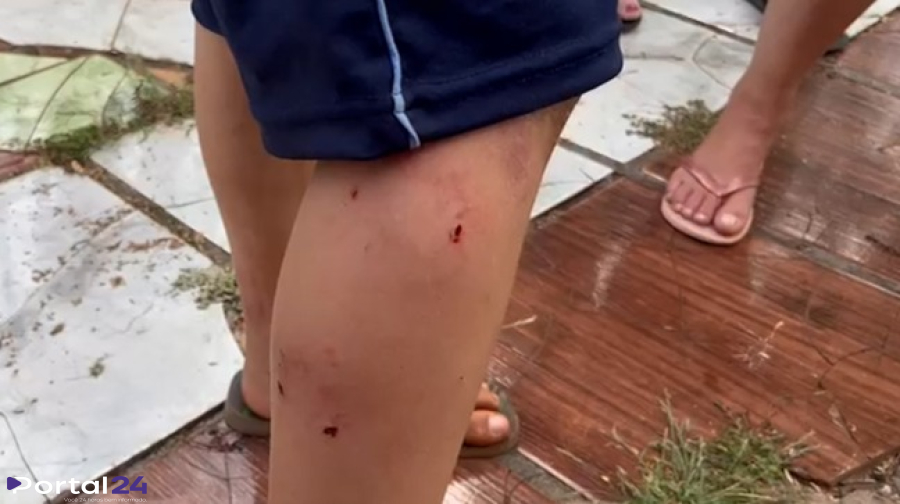 Câmera flagra ataque de cachorro a criança no bairro Floresta, em Cascavel