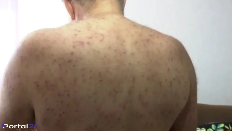 Aposentado sobrevive após ataque de enxame com mil picadas de abelha em Ponta Grossa